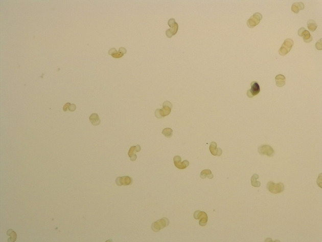 Pine Pollen Slides - Pine Pollen 01 100X